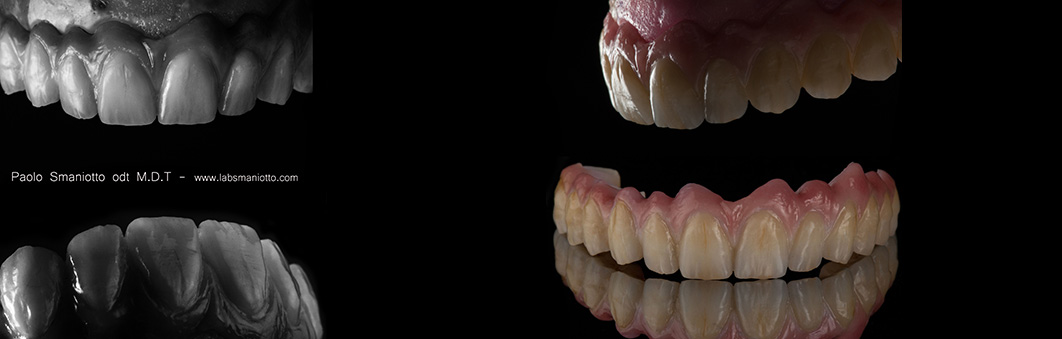 Partially-Stratified-Zirconia