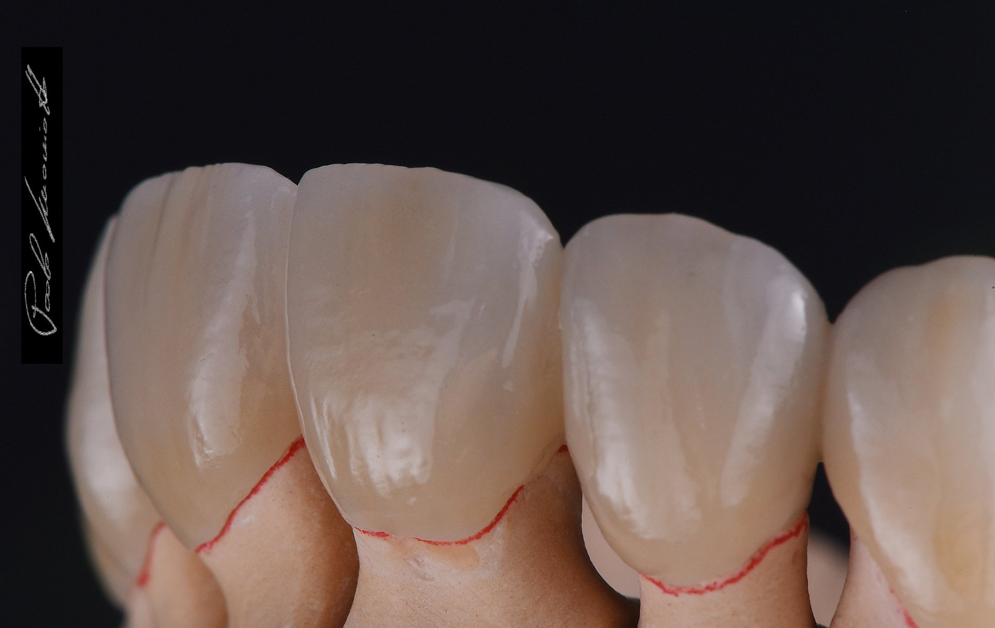 Laboratorio Odontoiatrico Smaniotto009