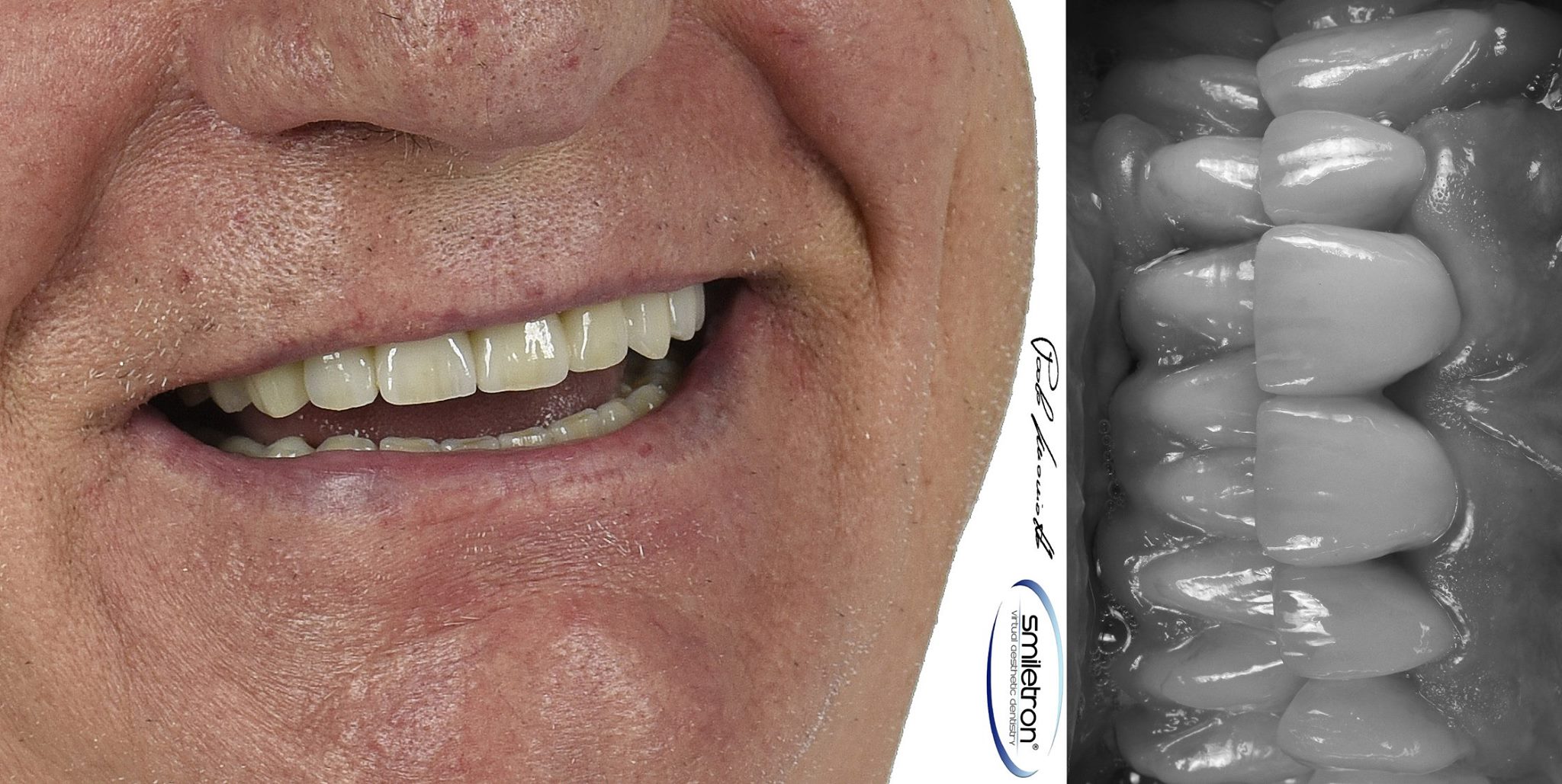 Laboratorio Odontoiatrico Smaniotto012