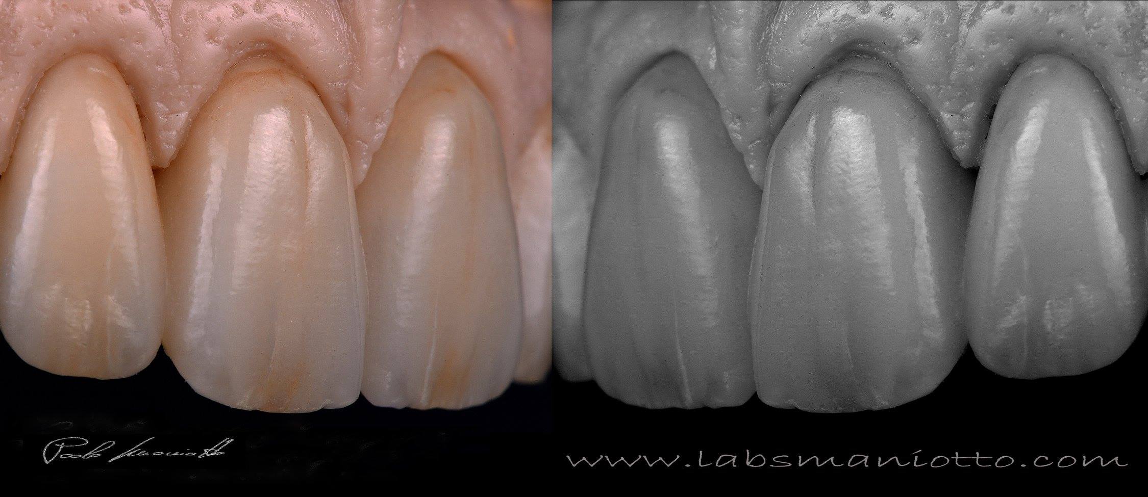 Laboratorio Odontoiatrico Smaniotto066