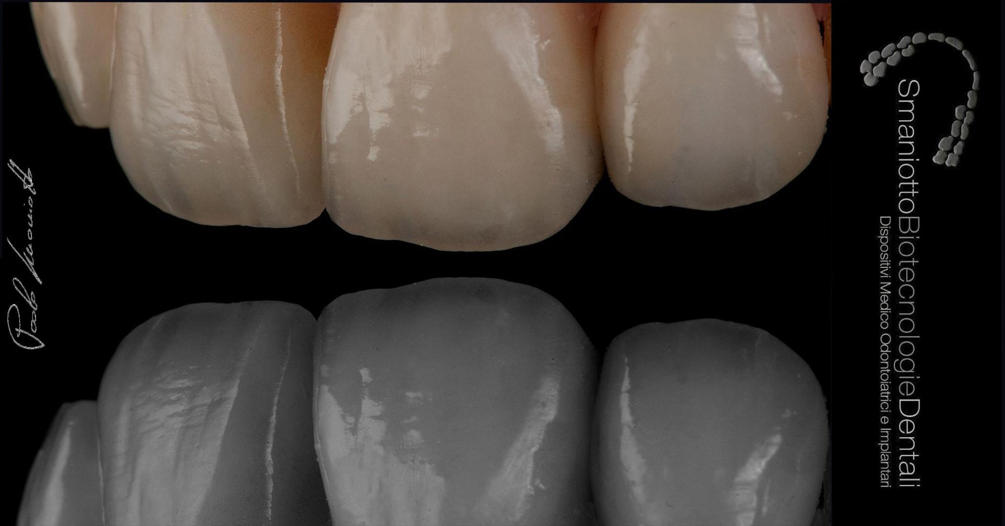 Laboratorio Odontoiatrico Smaniotto110