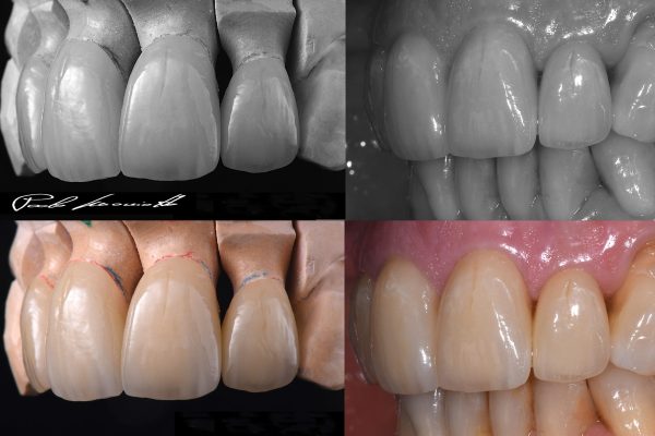 Laboratorio Odontoiatrico Smaniotto003