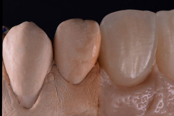 Laboratorio Odontoiatrico Smaniotto006