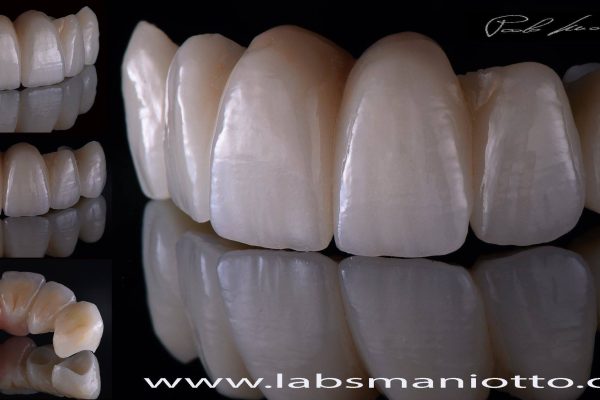 Laboratorio Odontoiatrico Smaniotto010