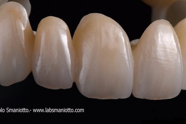 Laboratorio Odontoiatrico Smaniotto023