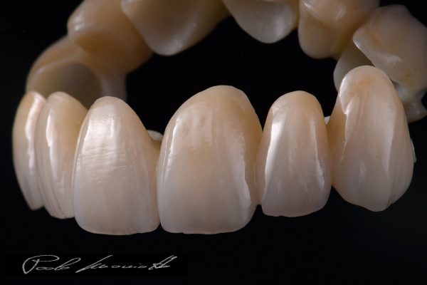 Laboratorio Odontoiatrico Smaniotto025