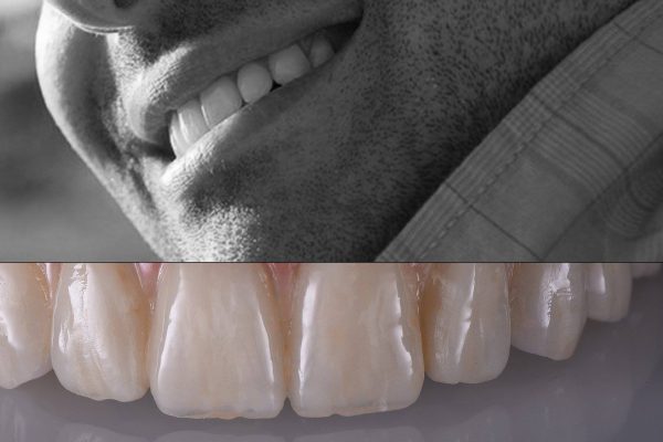 Laboratorio Odontoiatrico Smaniotto039