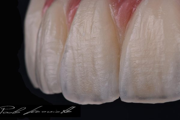 Laboratorio Odontoiatrico Smaniotto041