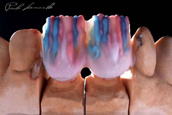 Laboratorio Odontoiatrico Smaniotto048