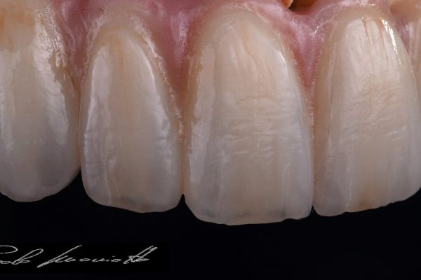 Laboratorio Odontoiatrico Smaniotto051