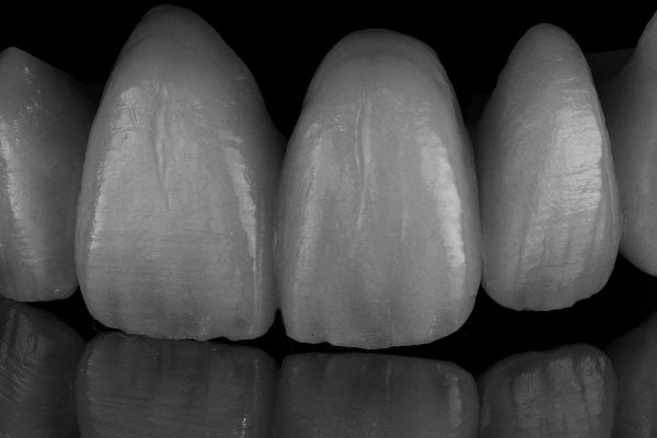 Laboratorio Odontoiatrico Smaniotto057