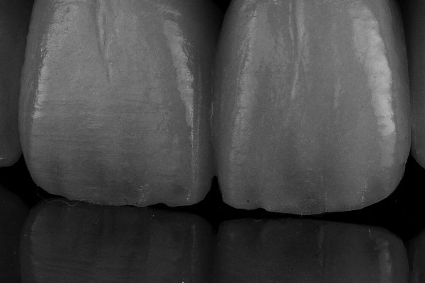 Laboratorio Odontoiatrico Smaniotto060