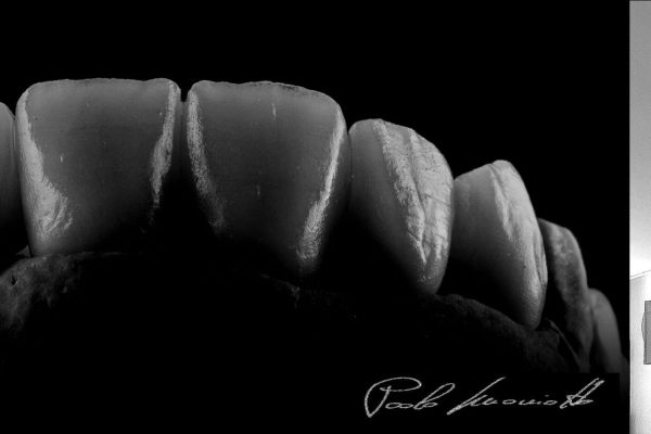 Laboratorio Odontoiatrico Smaniotto061