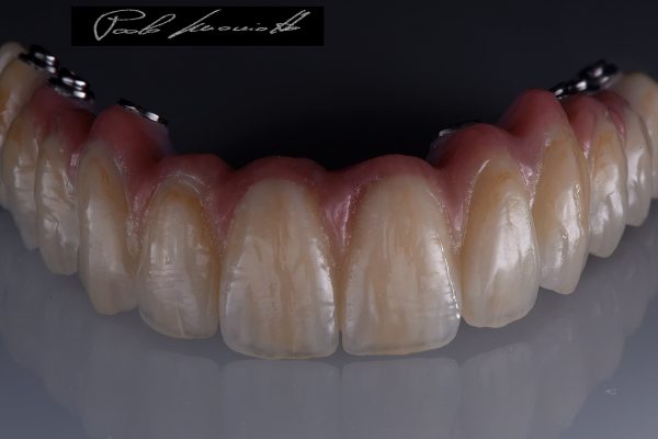 Laboratorio Odontoiatrico Smaniotto062