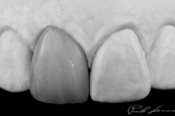 Laboratorio Odontoiatrico Smaniotto063