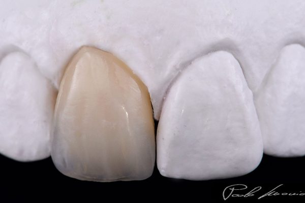 Laboratorio Odontoiatrico Smaniotto064