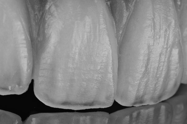 Laboratorio Odontoiatrico Smaniotto065