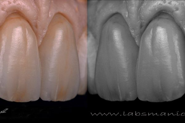 Laboratorio Odontoiatrico Smaniotto066