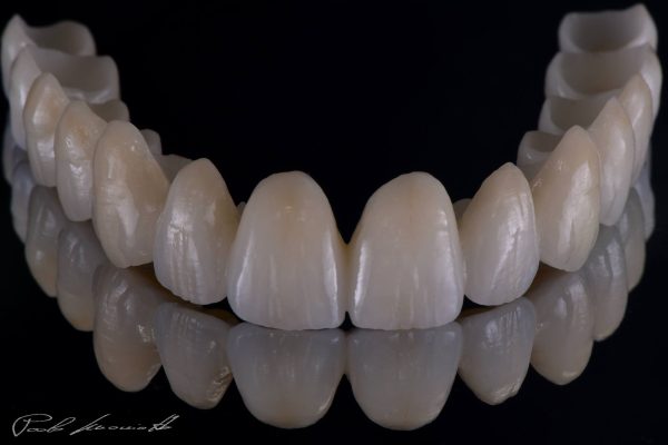 Laboratorio Odontoiatrico Smaniotto072