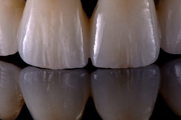 Laboratorio Odontoiatrico Smaniotto073