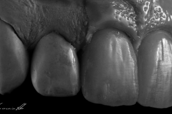 Laboratorio Odontoiatrico Smaniotto081