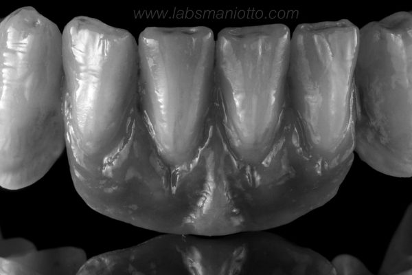 Laboratorio Odontoiatrico Smaniotto113