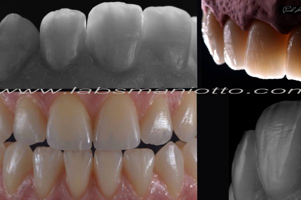 Laboratorio Odontoiatrico Smaniotto114