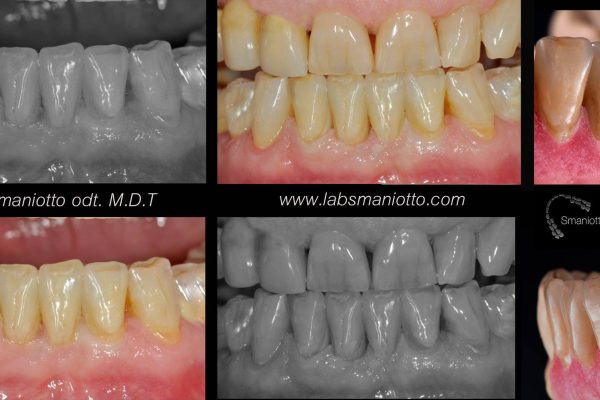 Laboratorio Odontoiatrico Smaniotto119