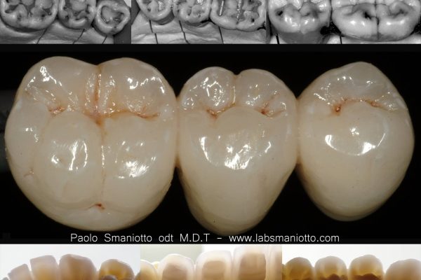 Laboratorio Odontoiatrico Smaniotto130
