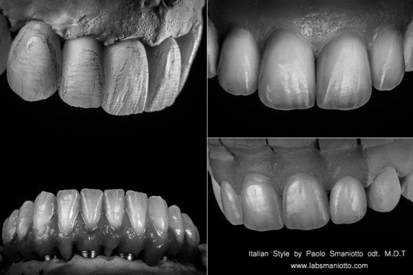 Laboratorio Odontoiatrico Smaniotto134