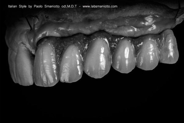 Laboratorio Odontoiatrico Smaniotto135