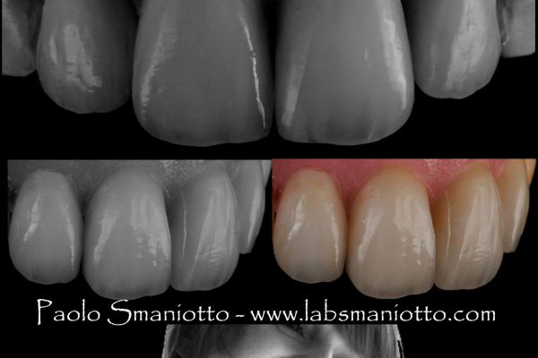 Laboratorio Odontoiatrico Smaniotto138